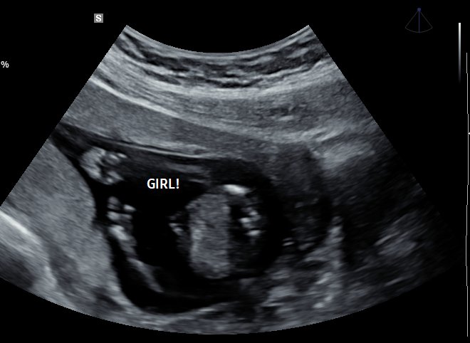 Gender reveal