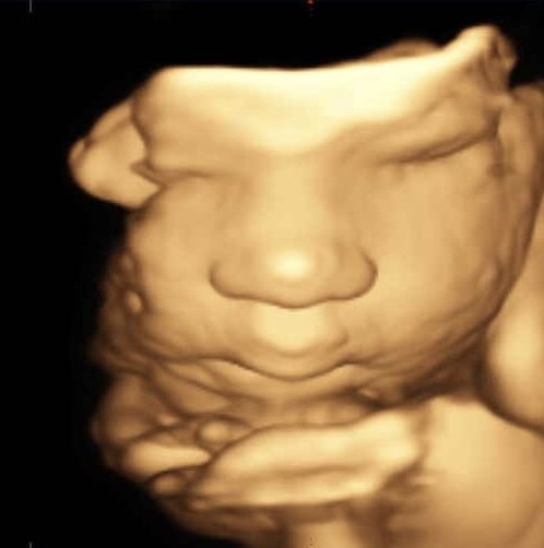 3D baby face